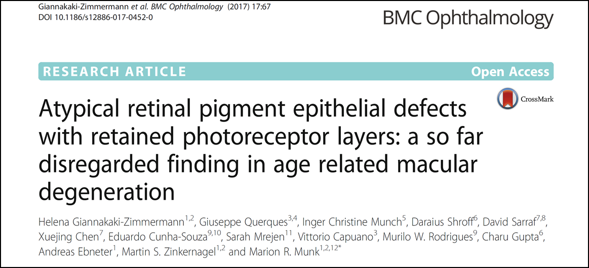 BMC Ophthalmology Journal